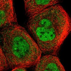 ANKRD23 Antibody, Novus Biologicals:Antibodies:Primary Antibodies